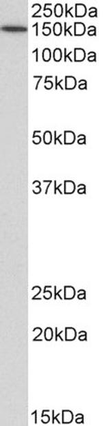 CD13 Antibody in Western Blot (WB)