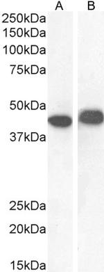 AMACR Antibody in Western Blot (WB)