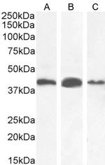 AMACR Antibody in Western Blot (WB)