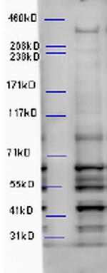 WDFY3 Polyclonal Antibody