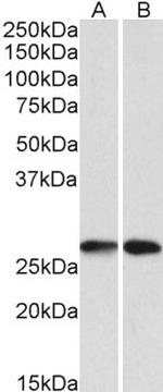 NNMT Polyclonal Antibody