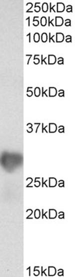 NNMT Polyclonal Antibody