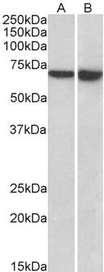 L-Plastin Polyclonal Antibody