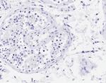 Acrosin Light Chain Antibody in Immunohistochemistry (Paraffin) (IHC (P))