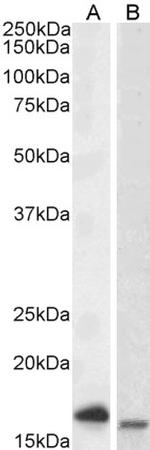 CD3 zeta (CD247) Polyclonal Antibody