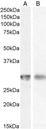 CD4 Antibody in Western Blot (WB)