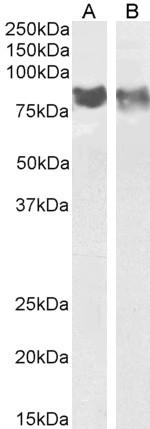 CD31 (PECAM-1) Antibody in Western Blot (WB)