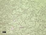 CD31 (PECAM-1) Antibody in Immunohistochemistry (Paraffin) (IHC (P))