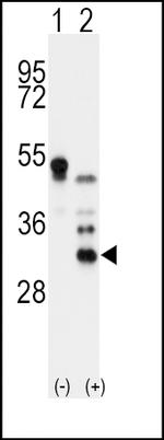 Apolipoprotein D Polyclonal Antibody