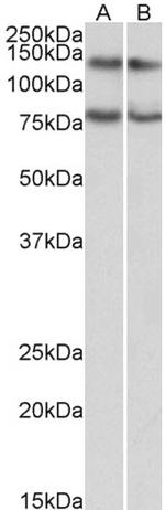 GPIP137 Antibody in Western Blot (WB)