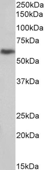uPAR (CD87) Polyclonal Antibody