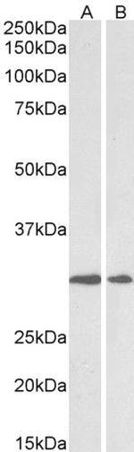 LOX Polyclonal Antibody