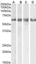 GABRG2 Antibody in Western Blot (WB)