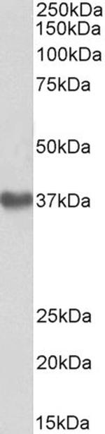 GNA12 Polyclonal Antibody