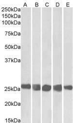 CK2 beta Polyclonal Antibody