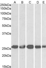 CK2 beta Polyclonal Antibody