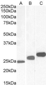CK2 beta Antibody in Western Blot (WB)