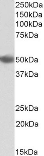 DC-SIGN (CD209) Antibody in Western Blot (WB)