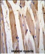 Vinculin Polyclonal Antibody