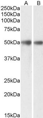 GDE1 Polyclonal Antibody
