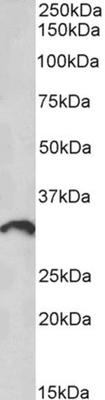 CD275 (B7-H2) Polyclonal Antibody