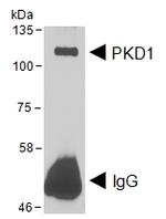 PKC mu Polyclonal Antibody