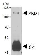 PKC mu Polyclonal Antibody