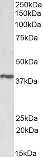 PTGR2 Polyclonal Antibody