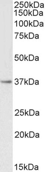 PTGR1 Polyclonal Antibody