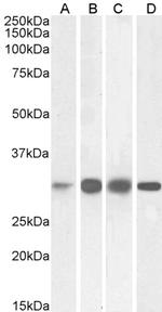 KHK Antibody in Western Blot (WB)