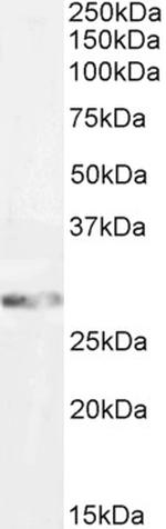 GSTM3 Polyclonal Antibody