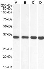 MDH2 Antibody in Western Blot (WB)