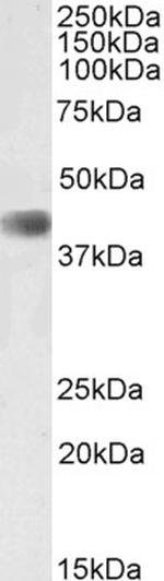CDK9 Polyclonal Antibody