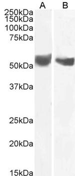 B7-H3 (CD276) Antibody in Western Blot (WB)