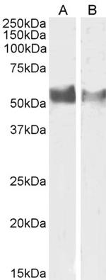 CD223 Antibody in Western Blot (WB)