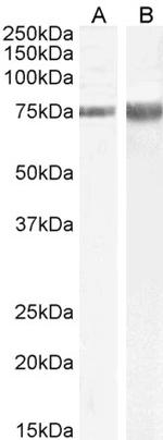 JIP1 Antibody in Western Blot (WB)