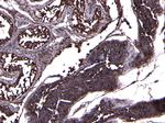 ACE2 Polyclonal Antibody