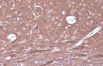 Phospho-PKC epsilon (Ser729) Polyclonal Antibody