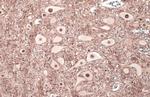 Phospho-Tau (Thr181) Antibody in Immunohistochemistry (Paraffin) (IHC (P))