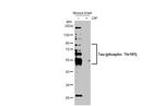 Phospho-Tau (Thr181) Antibody in Western Blot (WB)