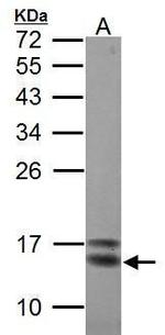 CRABP2 Antibody in Western Blot (WB)