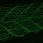 Dynamin 2 Antibody in Immunohistochemistry (PFA fixed) (IHC (PFA))