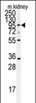 ADAM9 Polyclonal Antibody