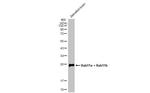 RAB11A/RAB11B Polyclonal Antibody