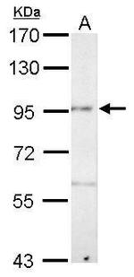 PCDH8 Antibody in Western Blot (WB)