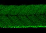VEGF Polyclonal Antibody