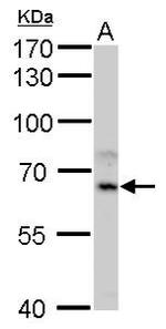 CYP1A1 Polyclonal Antibody