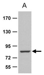 ZRANB1b Polyclonal Antibody