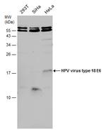 HPV Type 18 E6 Antibody in Western Blot (WB)