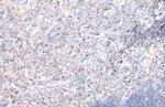 EOMES Polyclonal Antibody